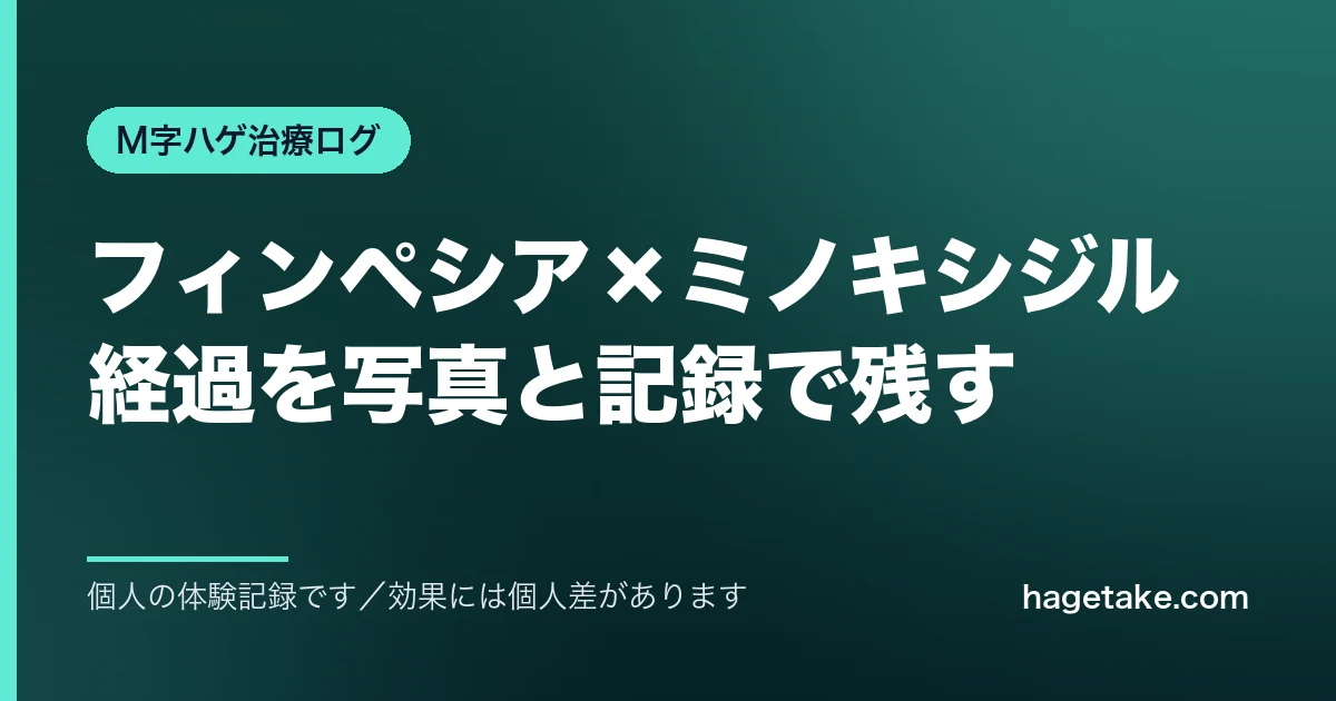 フィンペシアとミノキシジルによるM字部分の経過を記録した治療ログ